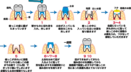 画像の説明