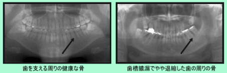 画像の説明